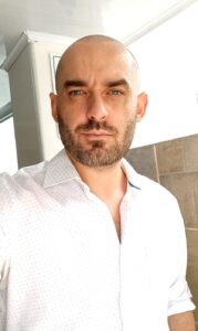 fue hair transplant in vancouver